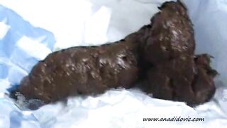 Hard poop in the bag