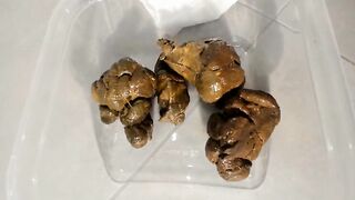 Plastic box filled with shit