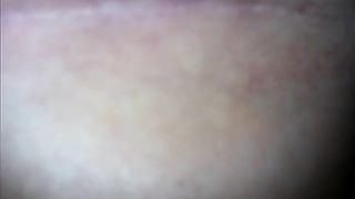 Long turd made her bleed