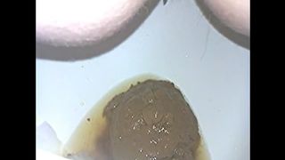 Soft and nasty poop