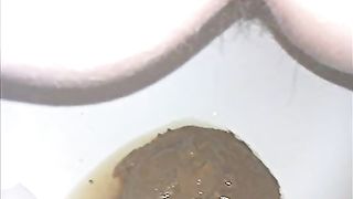 Soft and nasty poop