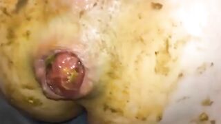 Dirty pooping asshole