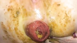 Dirty pooping asshole