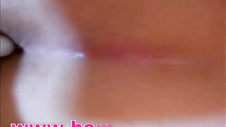 Suppository help for big dump