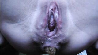 Mature lady shitting in closeup