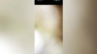 Pee and shit on the grass