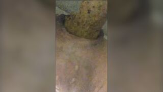 Shitting with prolapse POv