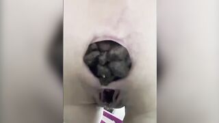 Closeup of gaping asshole