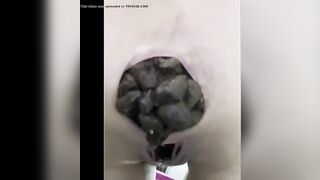 Closeup of gaping asshole