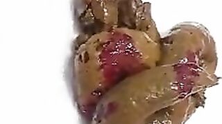 Hairy Japanese girl pooping bloody shit