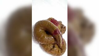 Hairy Japanese girl pooping bloody shit