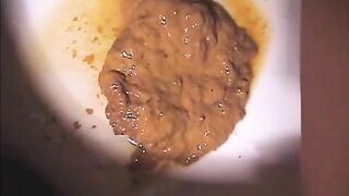 Fat poop and piss in closeup