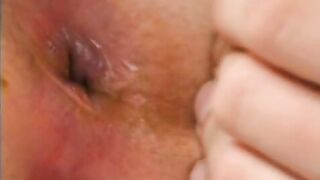 Fingering her shitty asshole