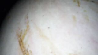 Girl shits in her pants in close up