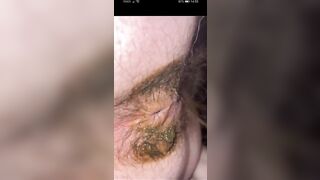 Hot hairy pooping asshole