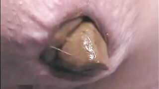 Girl shitting a very big turd POV