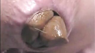 Girl shitting a very big turd POV