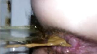 Hairy woman shitting closeup