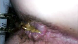 Hairy woman shitting closeup