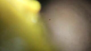 Sticky green poop in the bowl cam