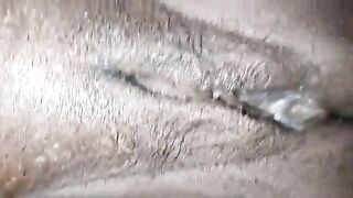 Wet sticky pussy and poop closeup