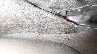 Wet sticky pussy and poop closeup