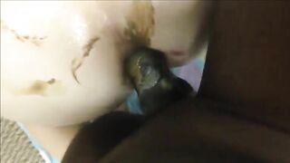 Hot Interracial anal fucking with shit