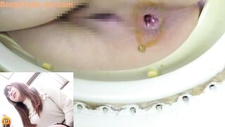 Cheeky looking Japanese milf caught pooping