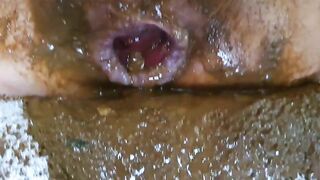 Dirty ass and messy poop