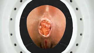 Kenya brown hot turd closeup