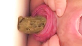 Prolapsed anus milf shitting