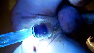 A pair of hands holds on to a clear hose with shit inside