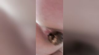 Closeup of pussy and poop