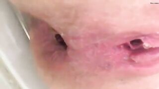 Cheeky asshole and poo