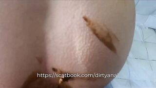 Asian horny babe taking hard anal scat pounding