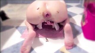 Anal insertion in prolapsed show