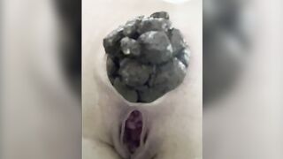 constipatioin shit closeup