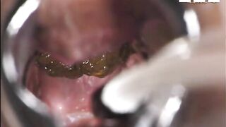 Deep inside asshole while pooping