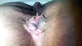 Hairy shit closeup