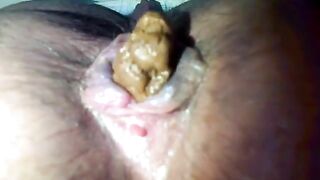 Hairy shit closeup
