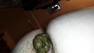 Hairy Ass Michelle close up turds