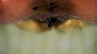 Stinky shit in the mouth