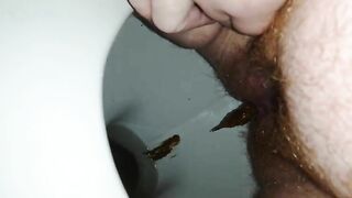 Hairy fat lady dropping shit