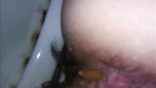 Hairy mom shitting very closeup