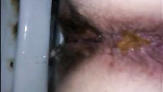 Hairy mom shitting very closeup