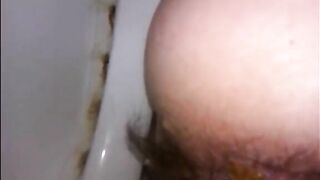 Hairy mom shitting very closeup