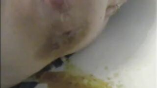 Woman shitting a very liquid diarrhea closeup