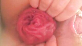 Woman pulls out a huge, nasty brown turd from her ass