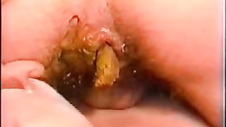 Sixty nine with crap