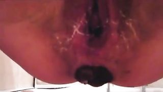 Hairy girl shitting